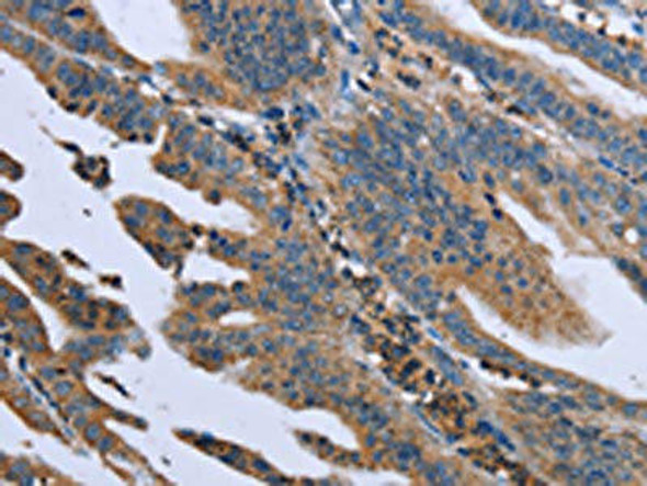 GNAI3 Antibody (PACO16389)