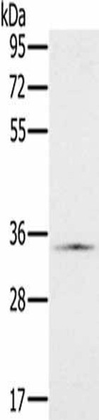 NDUFA9 Antibody (PACO16740)