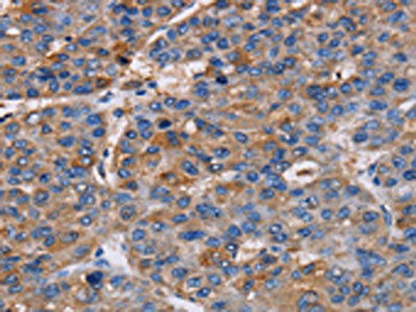 NPM3 Antibody (PACO16791)