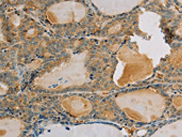 PARP3 Antibody (PACO16841)