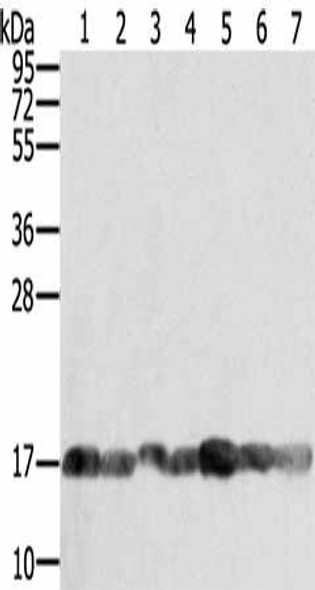 PPIA Antibody (PACO16887)
