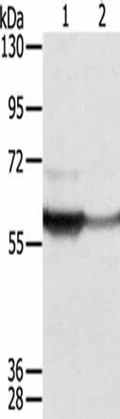 CTSA Antibody (PACO16895)