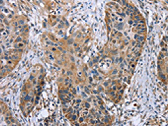 OPTN Antibody (PACO16902)