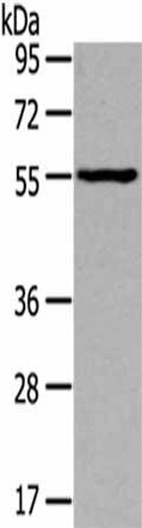 THRA Antibody (PACO17238)