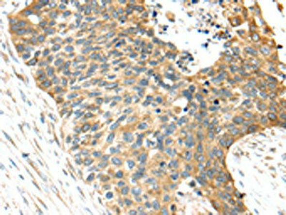 TNFAIP8 Antibody (PACO17289)