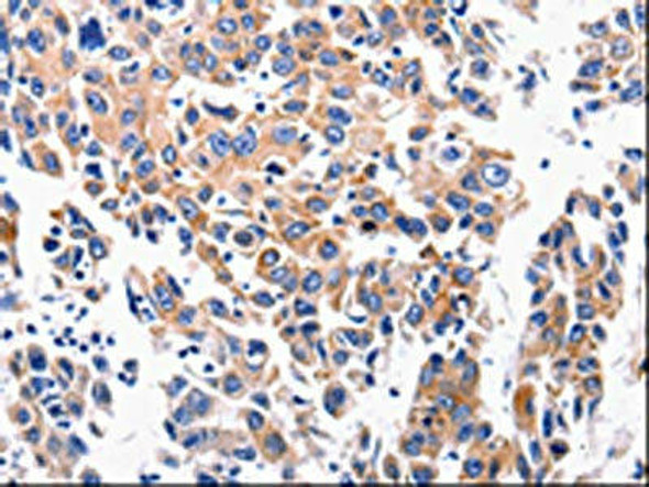 ACE2 Antibody (PACO17481)