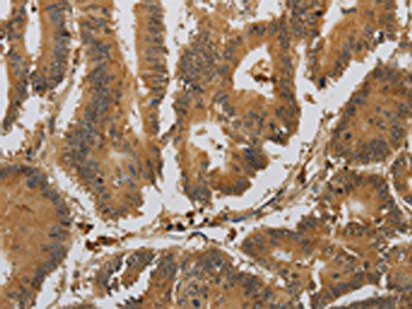 ACHE Antibody (PACO17484)