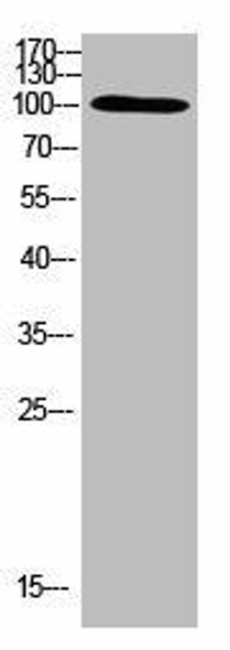 TRPV4 Antibody (PACO07462)