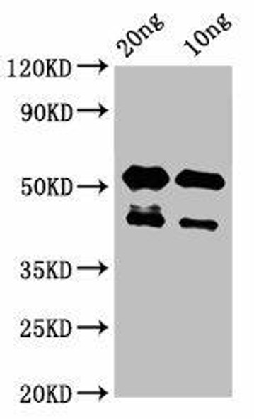 lats2 Antibody (PACO61330)