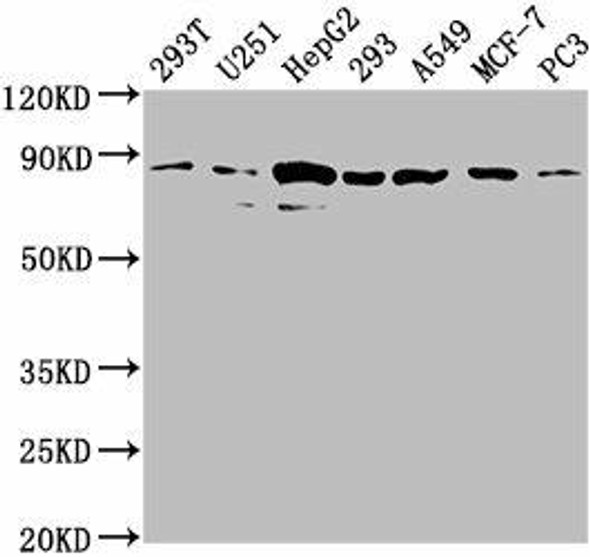 AMOTL2 Antibody (PACO62063)