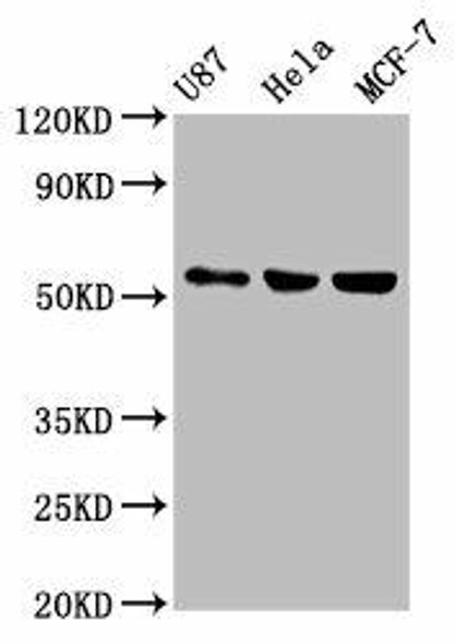 MEF2A Antibody (PACO62323)