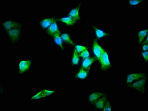 ALMS1 Antibody (PACO62563)