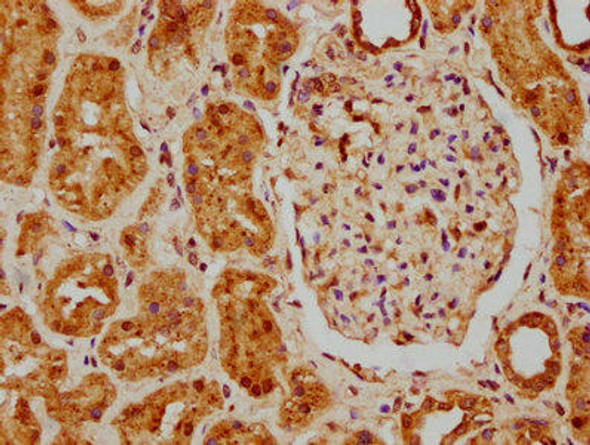 MSRA Antibody (PACO62619)
