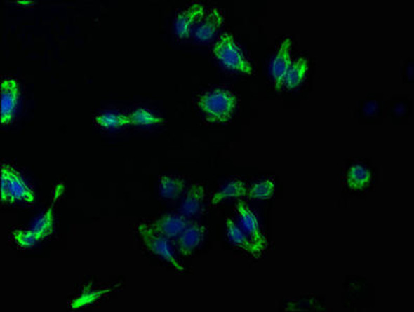 GPC3 Antibody (PACO63019)