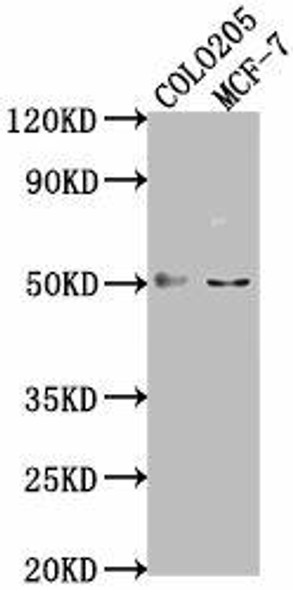 LRAT Antibody (PACO63347)