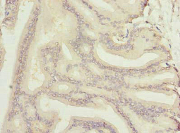 NOL6 Antibody (PACO41090)