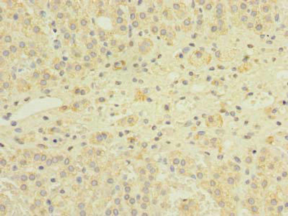 GEMIN8 Antibody (PACO41194)