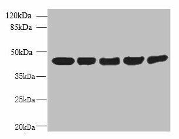 ACTRT3 Antibody (PACO41558)