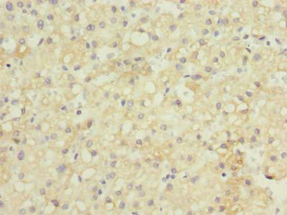 GDF2 Antibody (PACO42498)