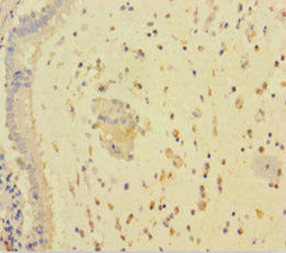 RARRES3 Antibody (PACO42518)