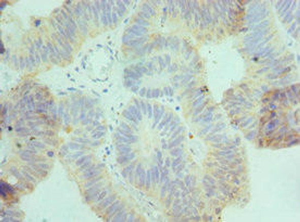 CSRNP1 Antibody (PACO43100)