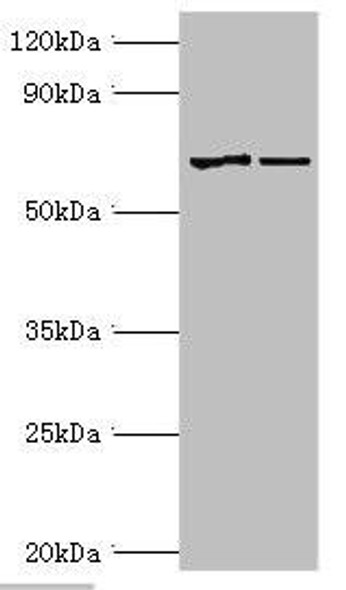 MTM1 Antibody (PACO43264)