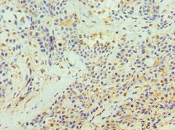 TFPI2 Antibody (PACO43342)