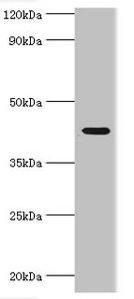 SIRT3 Antibody (PACO43376)