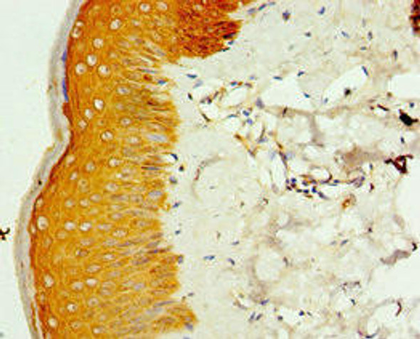 SMYD4 Antibody (PACO43643)