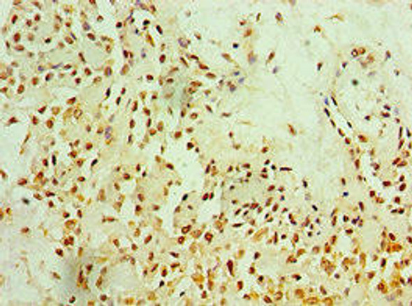 MTDH Antibody (PACO43753)