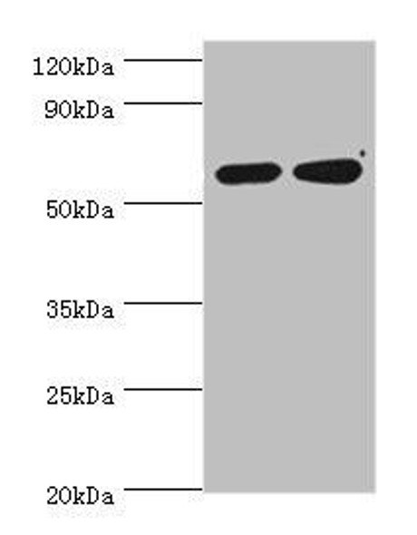 P4HA2 Antibody (PACO43821)