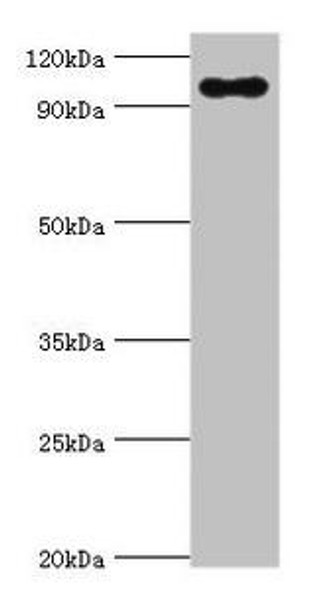 TGS1 Antibody (PACO43840)