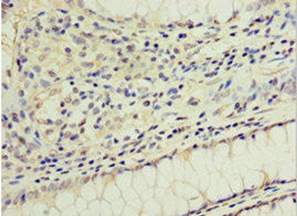 GOSR1 Antibody (PACO43911)