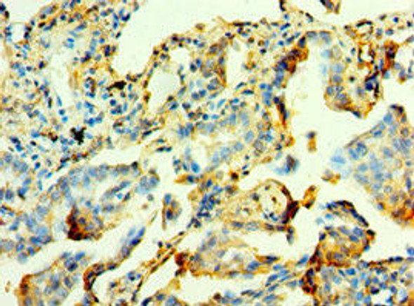 MYOT Antibody (PACO43922)