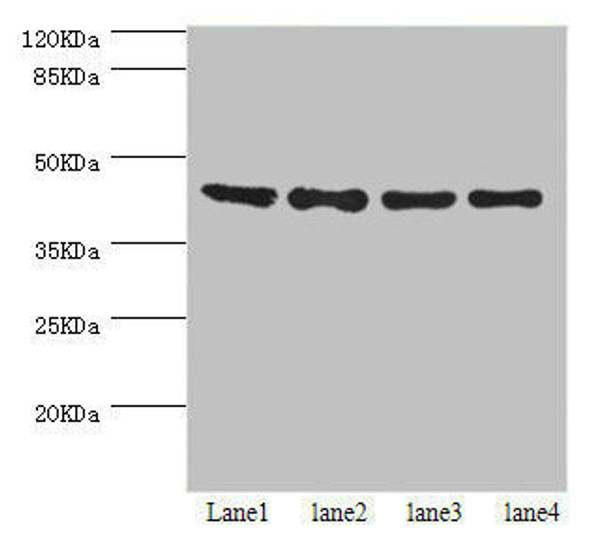 HERPUD1 Antibody (PACO44345)