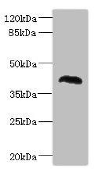 NHLRC1 Antibody (PACO44355)