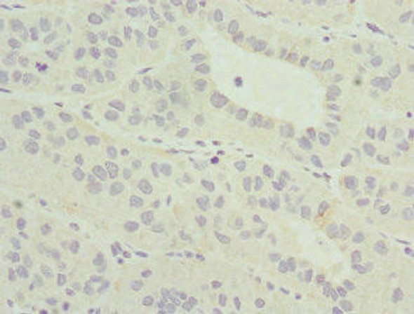 MLLT3 Antibody (PACO44394)