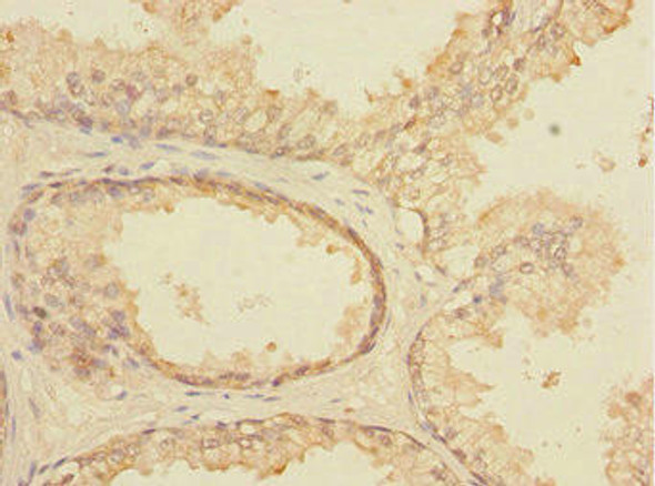 ELF5 Antibody (PACO44573)