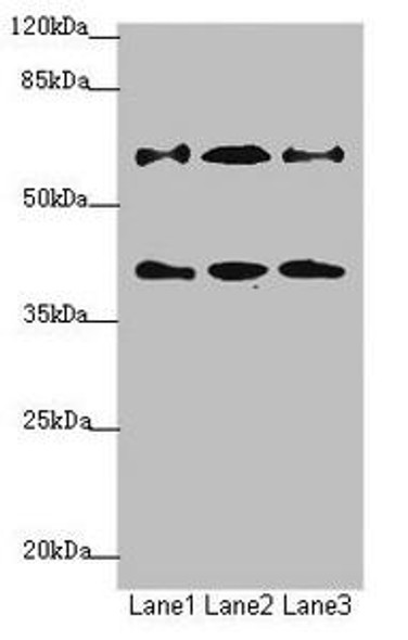 DCP1A Antibody (PACO44621)