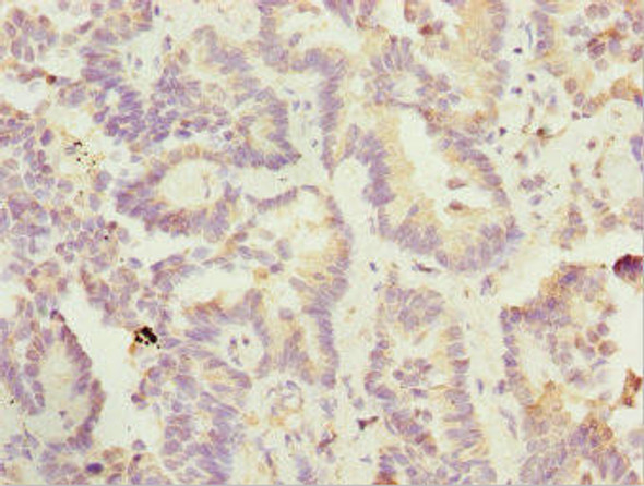 SIK3 Antibody (PACO44691)