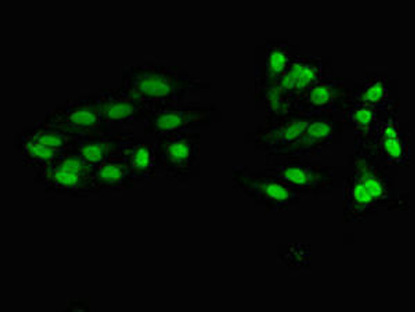 ZNF331 Antibody (PACO53066)