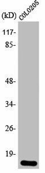 EIF4EBP1 Antibody (PACO00346)