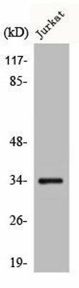 CA14 Antibody (PACO00492)