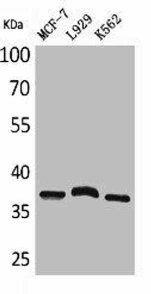 CD79B Antibody (PACO01960)