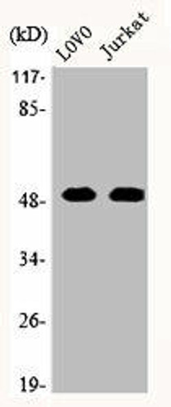 MAPK10 Antibody (PACO06601)