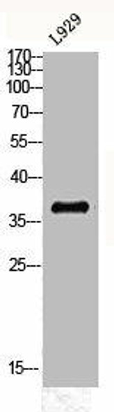 MT-ND1 Antibody (PACO06673)