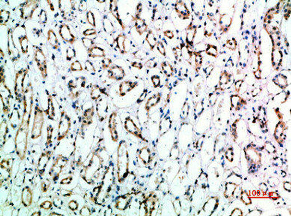 CD151 Antibody (PACO07361)