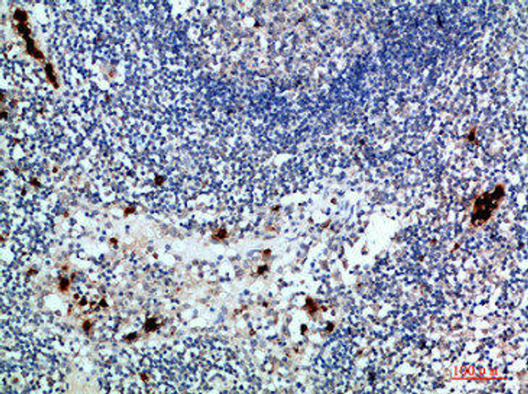 ZAP70 Antibody (PACO07389)