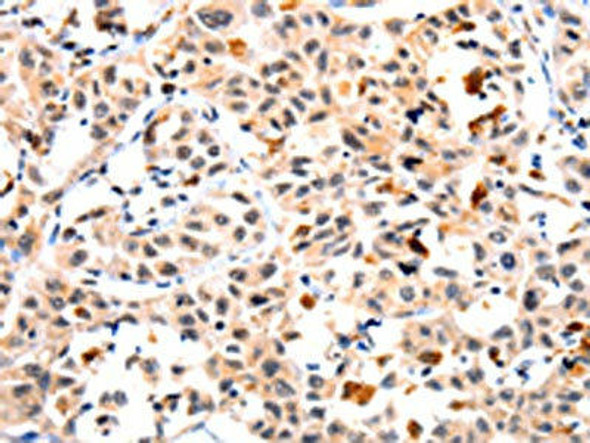 IL23R Antibody (PACO13989)