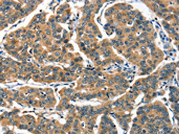 ALOX15 Antibody (PACO19272)